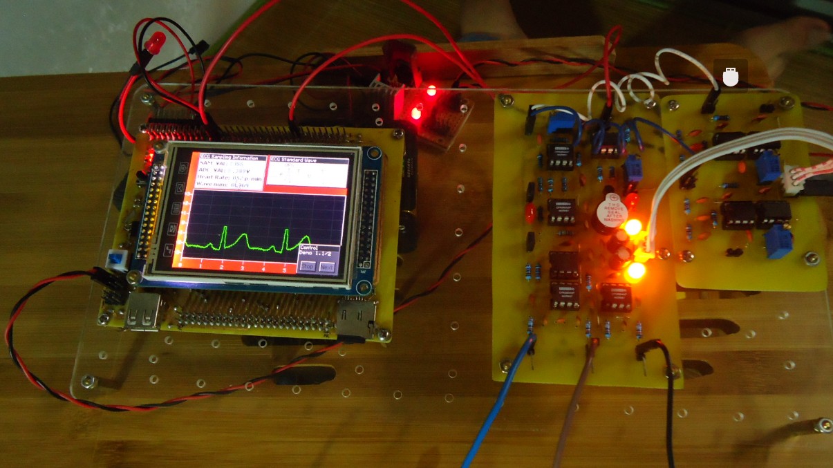 å¿çµæ¿åSTM32.jpg