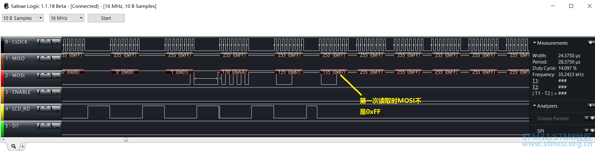 1-å¼å¸¸çSDå¡è¯»åæ¶åº.png