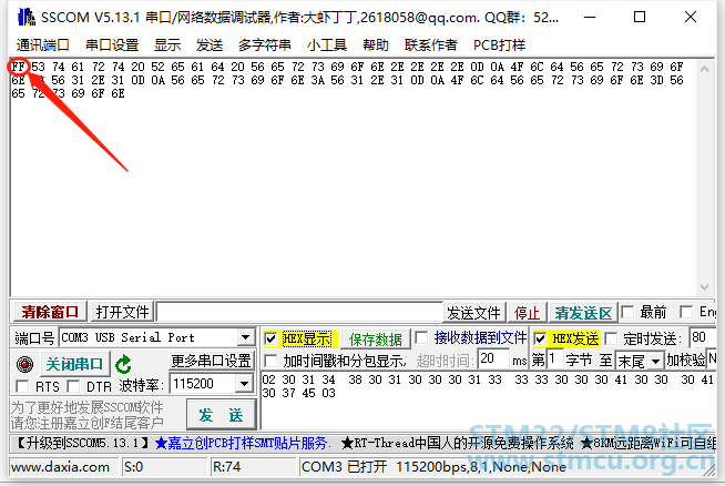 3 ä¸²å£è°è¯å©ææ¥æ¶å°çå¼å¸¸æ°æ®.png