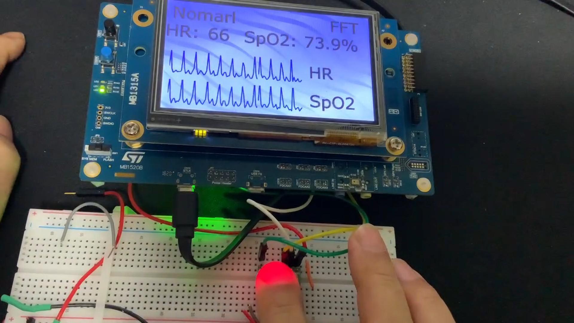 基于【STM32H735-DK】指尖血氧心率监护仪